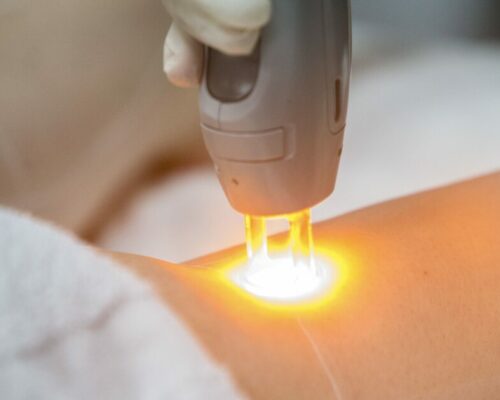 635486656982174566-PNI-met-laser 635486656982174566-PNI-met-laser